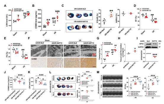治疗心肌缺血再灌注新策略——哈尔滨医科大学团队揭示NAT10调控心肌缺血再灌注的分子机制