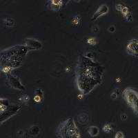 JEG-3细胞敲除hB2M基因细胞系