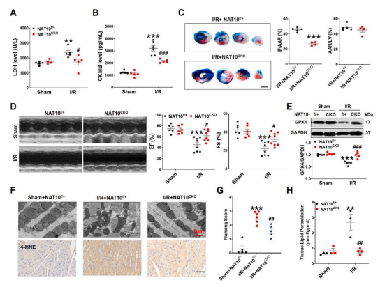 治疗心肌缺血再灌注新策略——哈尔滨医科大学团队揭示NAT10调控心肌缺血再灌注的分子机制