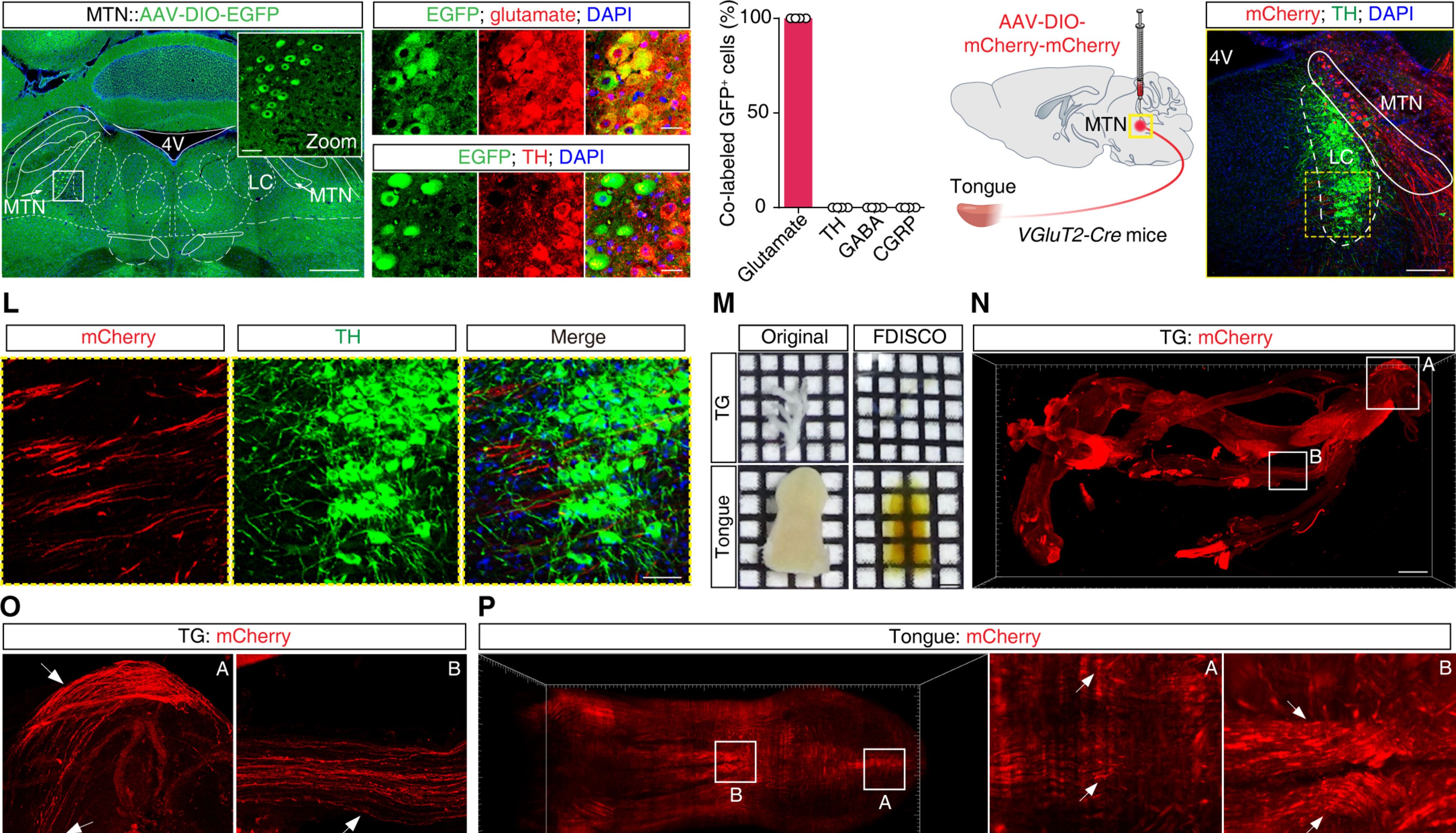 【客户文章】Sci Adv | 组织透明化结合电生理技术揭示唤醒麻醉行为关键环路