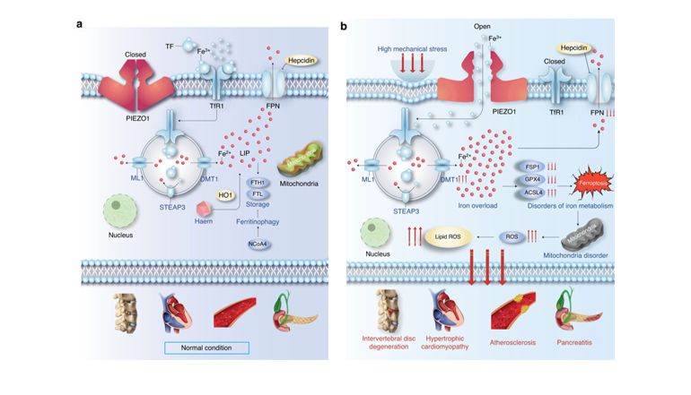 Piezo1 通道通过介导机械应力诱导的铁内流来加剧髓核细胞的铁死亡