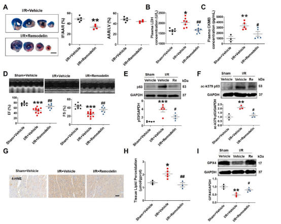 治疗心肌缺血再灌注新策略——哈尔滨医科大学团队揭示NAT10调控心肌缺血再灌注的分子机制