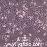 MHCC97-L人肝癌细胞(低转)