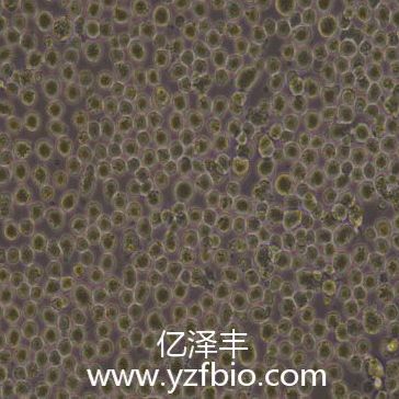 Thp-1人单核细胞白血病