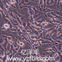 U251人神经胶质瘤细胞