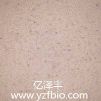 U-87MG人脑星形胶质母细胞瘤