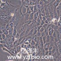 CFPAC-1人胰腺癌细胞