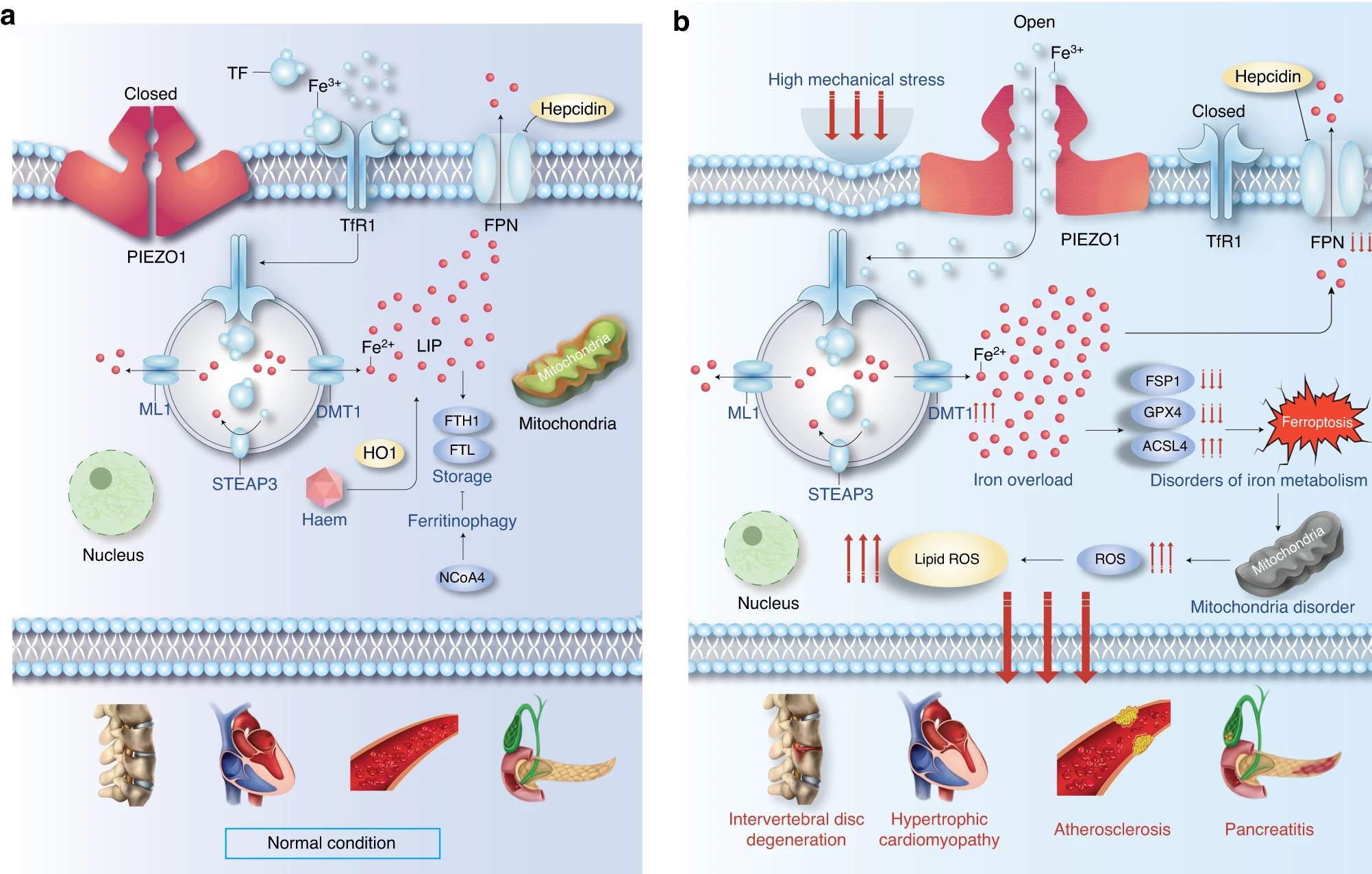 Piezo1 通道通过介导机械应力诱导的铁内流来加剧髓核细胞的铁死亡