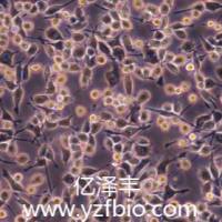 P815小鼠肥大细胞瘤细胞