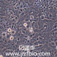 ISK子宫内膜癌细胞