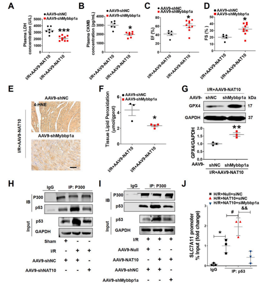 治疗心肌缺血再灌注新策略——哈尔滨医科大学团队揭示NAT10调控心肌缺血再灌注的分子机制