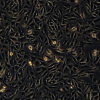 A498细胞敲除hCBX7基因细胞系