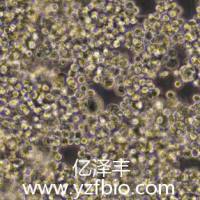 Walker/LLC-WRC 256大鼠腹水癌细胞