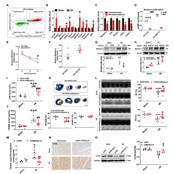 治疗心肌缺血再灌注新策略——哈尔滨医科大学团队揭示NAT10调控心肌缺血再灌注的分子机制