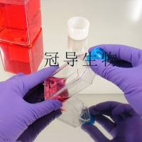 GM12878人B淋巴细胞系