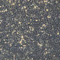 4T1细胞敲除mZdhhc20基因细胞系