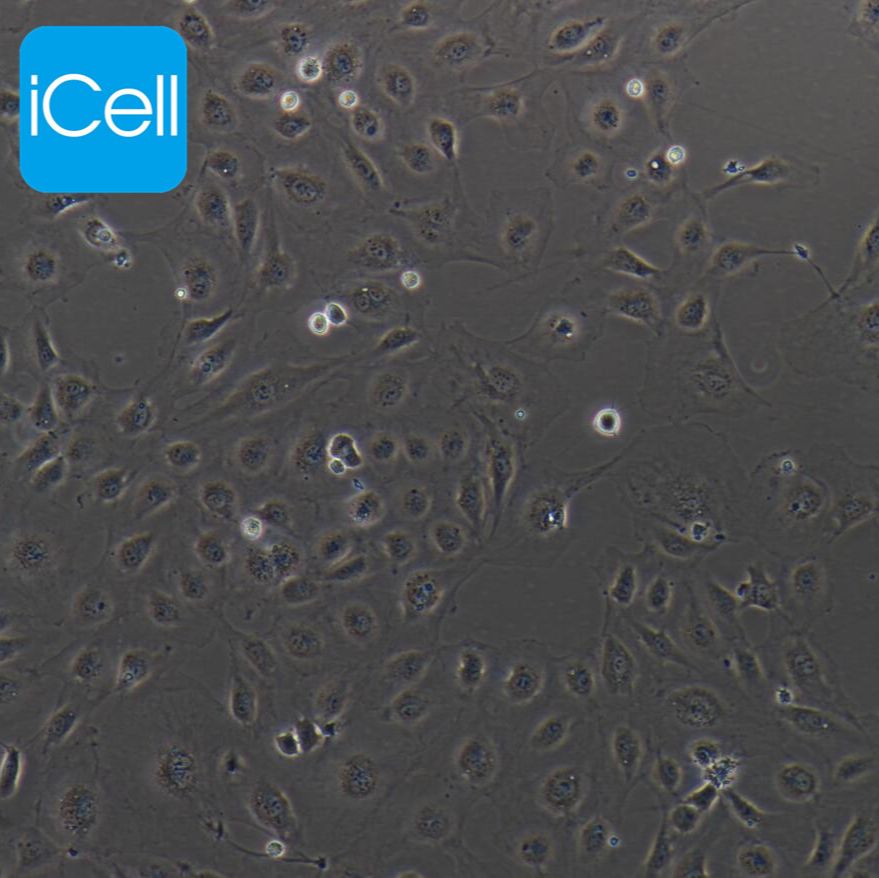 HUVEC HUVEC细胞 人脐静脉内皮细胞 脐静脉内皮细胞/免疫荧光鉴定