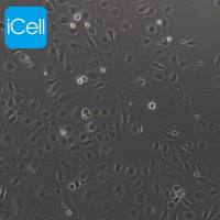 HUVEC HUVEC细胞 人脐静脉内皮细胞 脐静脉内皮细胞/免疫荧光鉴定