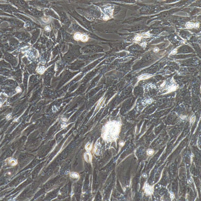 骨髓间充质干细胞/主动脉内皮细胞/免疫荧光鉴定