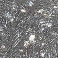 骨髓间充质干细胞/主动脉内皮细胞/免疫荧光鉴定