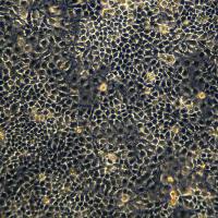 HuH-7细胞敲除hTIMM17B基因细胞系