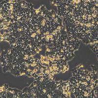 HCT 116细胞敲除hS1PR3基因细胞系