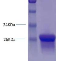 Q热贝氏柯克斯体重组外膜蛋白1