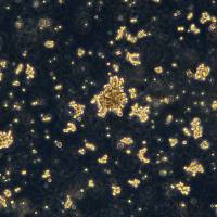 SK-HEP-1细胞敲除hHSP90AA1基因细胞系