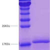 鼠疫耶尔森氏菌F1重组蛋白