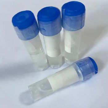 beta Amyloid 1-42 Antibody