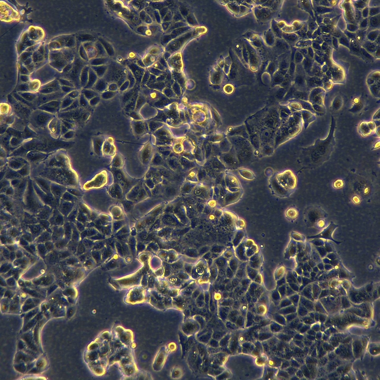 MCF7细胞敲除hPIP4K2B基因细胞系