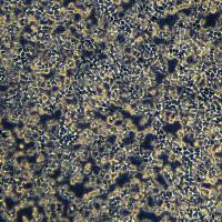 HEK293T细胞敲除Human EIF2AK3基因细胞系