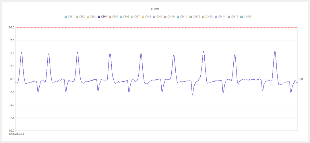 哮喘——全身体积描记系统(Whole Body Plethysmography——WBP)