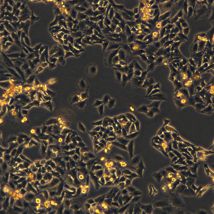 Hela细胞敲除human SLC8B1基因细胞系