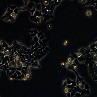 HCT116-Luc细胞敲除hCLCA1基因细胞株