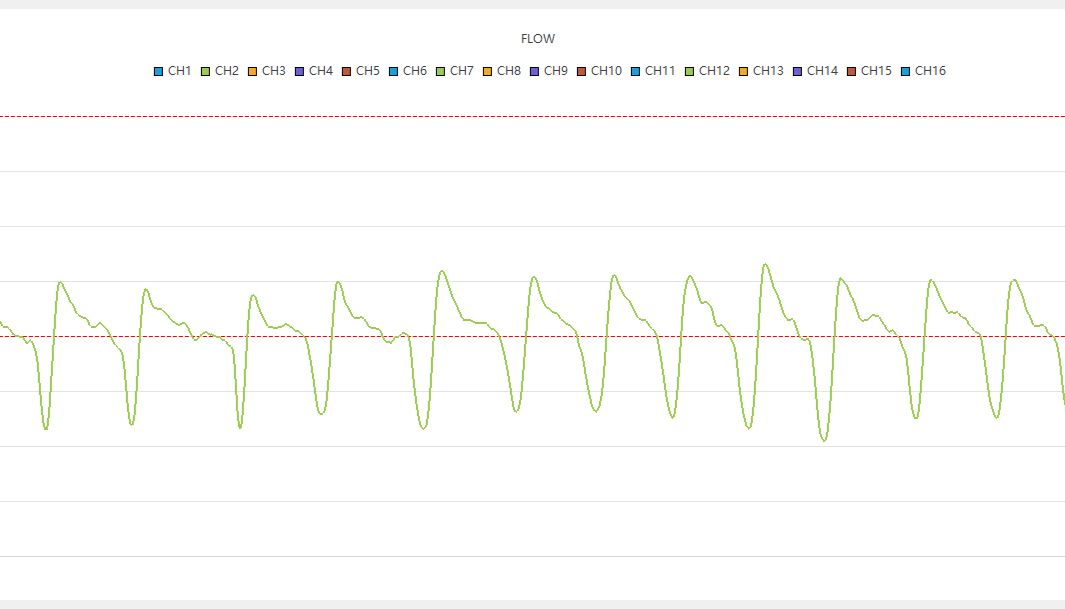 哮喘——全身体积描记系统（Whole Body Plethysmography——WBP）