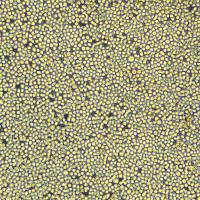 SNU-1细胞敲除hMNX1基因细胞株