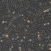 U251细胞敲除hOXSR1基因细胞系