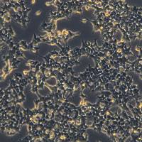 HEK293细胞敲除hUSP25基因细胞系