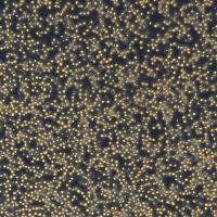 Mv-4-11细胞敲除hCEBPA-DT基因细胞株