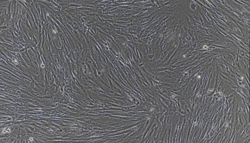 小鼠肺微血管内皮细胞的分离培养方法