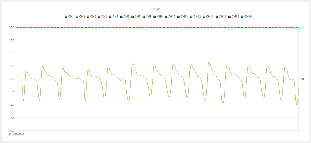 哮喘——全身体积描记系统(Whole Body Plethysmography——WBP)