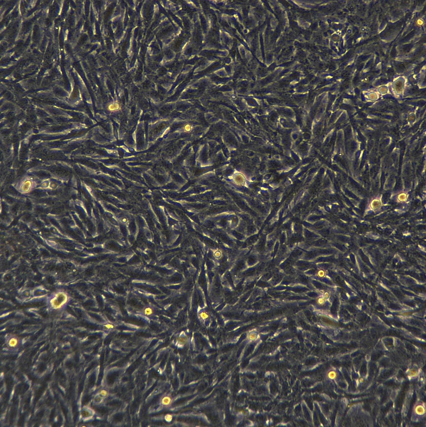 U251细胞敲除hSTK39基因细胞系