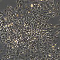 A549细胞敲除RB1基因细胞系