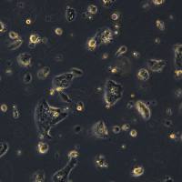 JEG-3细胞敲除hLUM(Lumican)基因细胞系