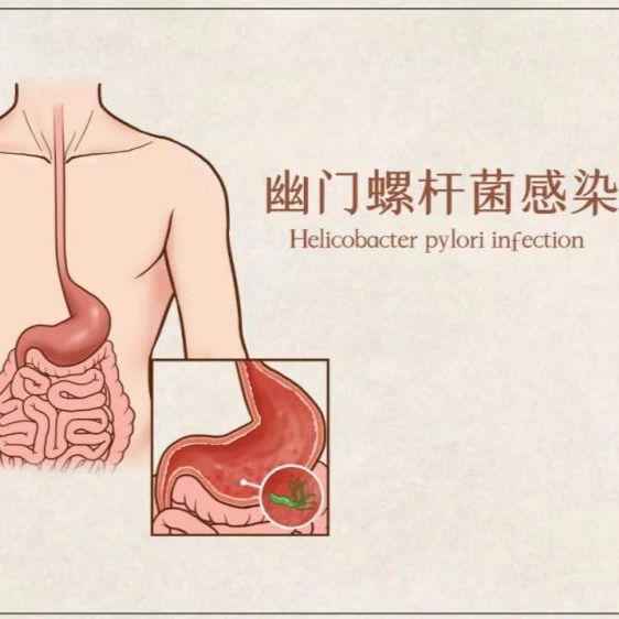 幽门螺杆菌核酸检测及VacA基因分型检测试剂盒（荧光PCR法）