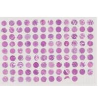 F106Ov01 卵巢癌Stage I-IV期芯片