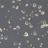 MCF-7细胞敲除hCASP6基因细胞系