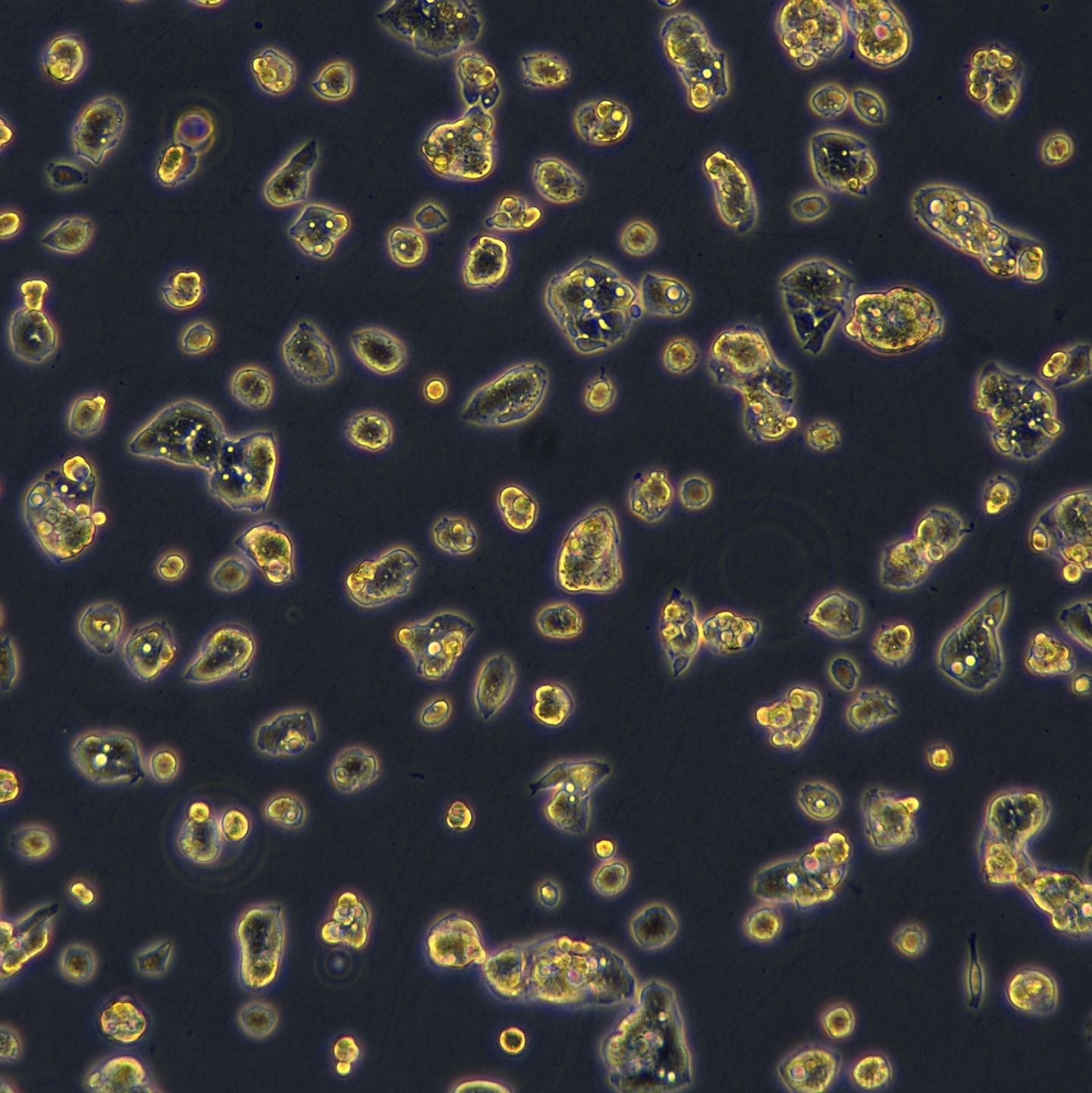 HepG2细胞敲除hALDO B基因细胞系