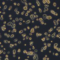 HepG2细胞敲除hALDO B基因细胞系